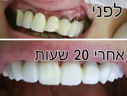 מהפכת הדיגיטל בתחום רפואת השיניים